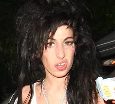 Amy Winehouse's Teeth After: - via Daymix