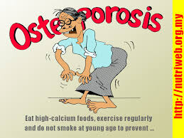 osteoporosis.jpg - via Daymix