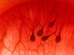 http://www.all-about-hematospermia.com/images/sperm.jpg