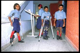  Poliomyelitis 