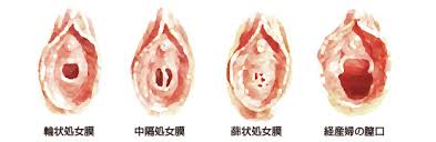 処女膜とは膣の入り口にある薄い