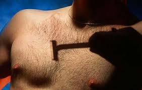 Men Hair Removal Options: