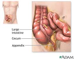  Appendectomy  - series