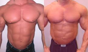 http://upload.wikimedia.org/wikipedia/commons/a/a3/Gynecomastia_in_Bodybuilder.jpg