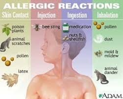  Allergic reactions 