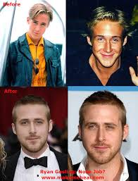 <b>ryan</b>-<b>gosling</b>-nose-job.jpg