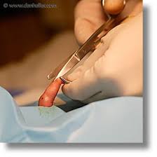  Circumcision  (12)