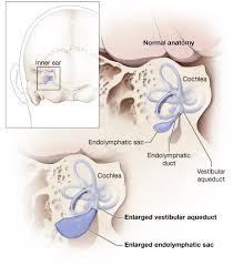 Diagram of the Inner Ear Diagram of    