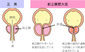 名前からすると前立腺が大きく
