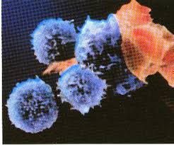 aids-virus.jpg