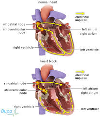 http://hcd2.bupa.co.uk/images/factsheets/heart_block_427x500.jpg