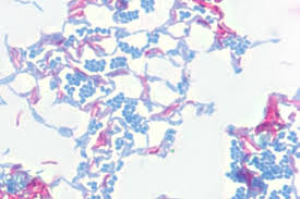 The  acid fast stain 