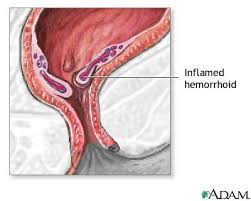 persistent  itching    anal   bleeding    