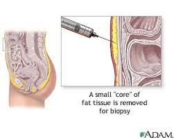 an  abdominal wall fat pad 