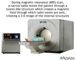  MRI scan  - illustration