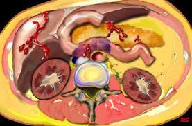 http://www.radiologyassistant.nl/images/thmb_43ce5595362a9abdom-trauma-child-abuse.jpg