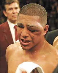 professional boxing - via Daymix