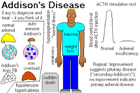 http://www.pathguy.com/lectures/addison.gif
