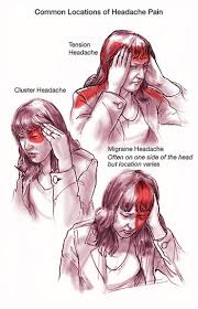  Headaches 