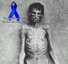 ANOREXIC PRIDE CENSORED