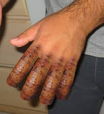 Sausage Fingers « DDPP™ Chicago