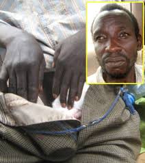 ナイフでペニスを切り落とさ