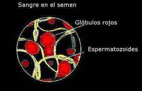 http://www.tbeeb.com/ph/files/1/health_topics/hemospermia.jpg