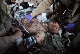 being wounded in an IED attack.