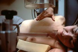 Breast Cancer