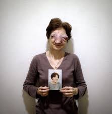 Chantal-Sebire-franc.