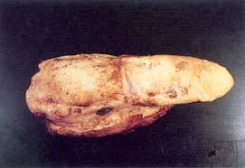 http://www.fao.org/docrep/003/t0756e/T0756E74.jpg