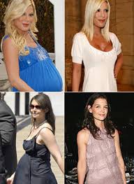 Body After Baby