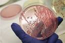 WHO: Food poisoning strain never detected before - Health - Food ...