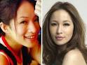 Elva Hsiao - Celebs and plastic surgery: Who did it?