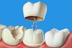 Dr Peter Derham Family Dentistry