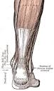 Achilles Tendon Rupture The O'Leary Studio of Highland and Irish ...