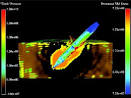 the nuclear information project: the B61-
