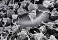 platelets pronunciation
