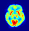International Psychoanalysis » Blog Archive » Study of How Brain ...