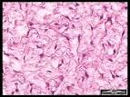 Connective Tissue
