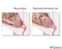 Signs of Labor - How to Tell Your Baby is Coming with the Signs of ...