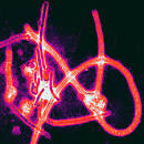 Color-enhanced electron micrograph of Ebola virus | Flickr - Photo ...