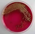 Source of large E-coli outbreak will probably not be found says ...