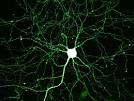 Hippocampal neuron expressing Green Fluorescent Protein :: Strange ...