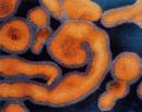 Ebola Virus Case Reported in Uganda | African Post