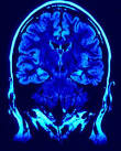 New Testament Apostolic Mental Illness Info Page