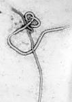 File:Ebola virus em.jpg - Wikipedia, the free encyclopedia
