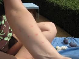 Bed bugs? (Thailand) : Travellerspoint Travel Photography