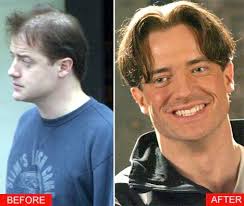 Image <b>Brendan Fraser's</b> hair Picture
