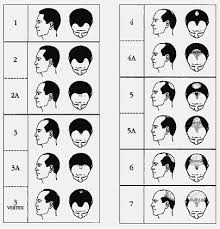 Cause of hair loss: male
